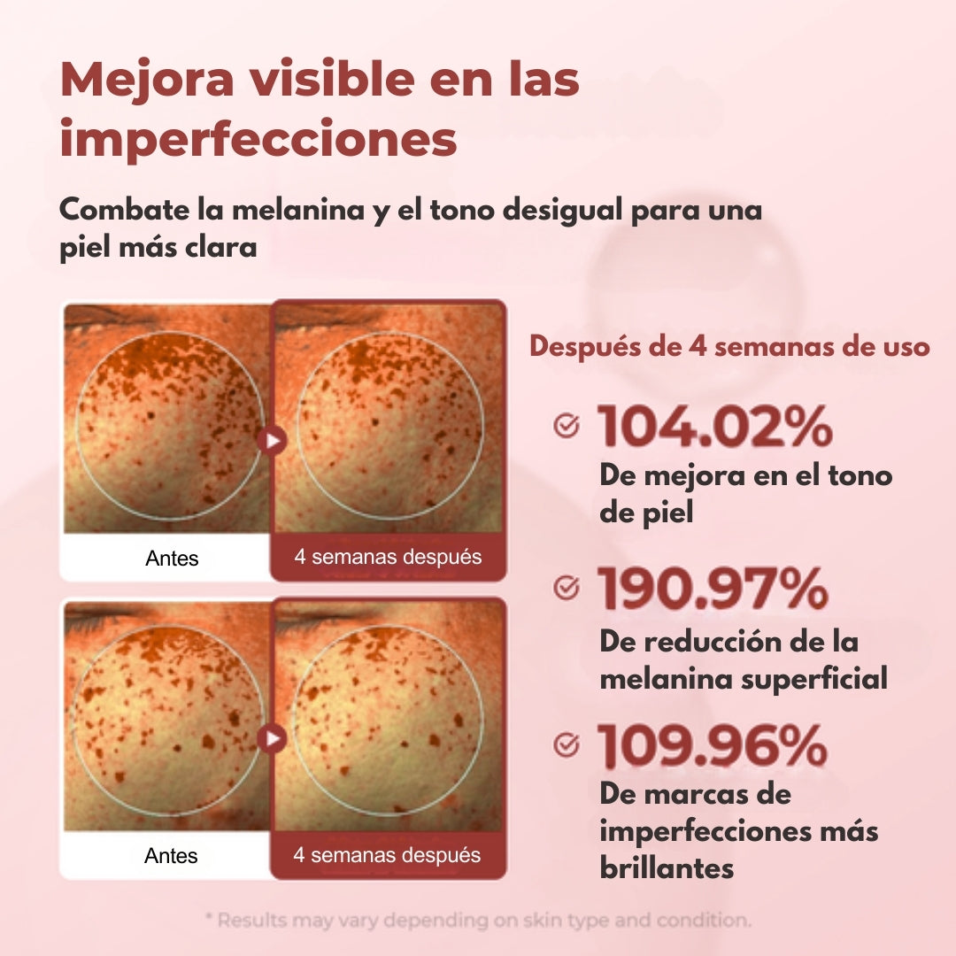 Dile Adiós Al Acné Y Las Manchas De Una Vez Con Kormesic™