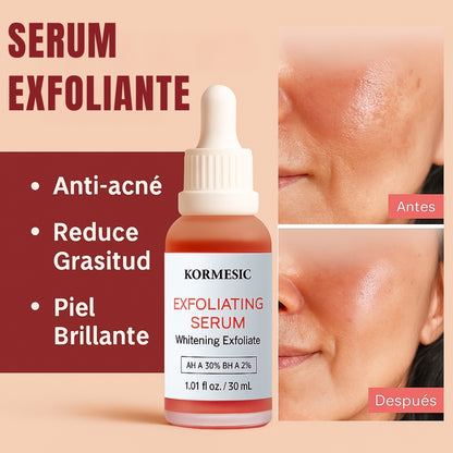 Dile Adiós Al Acné Y Las Manchas De Una Vez Con Kormesic™